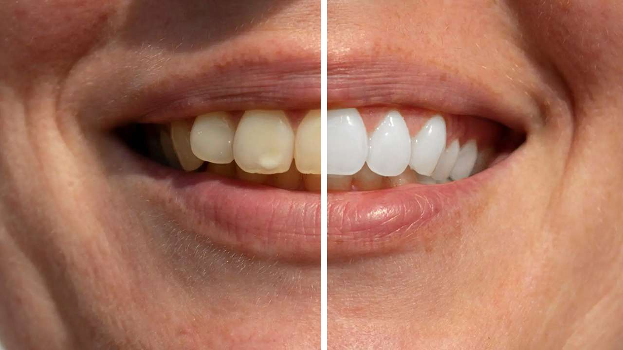 Read more about the article The Easiest Way To Whiten Teeth in Photoshop